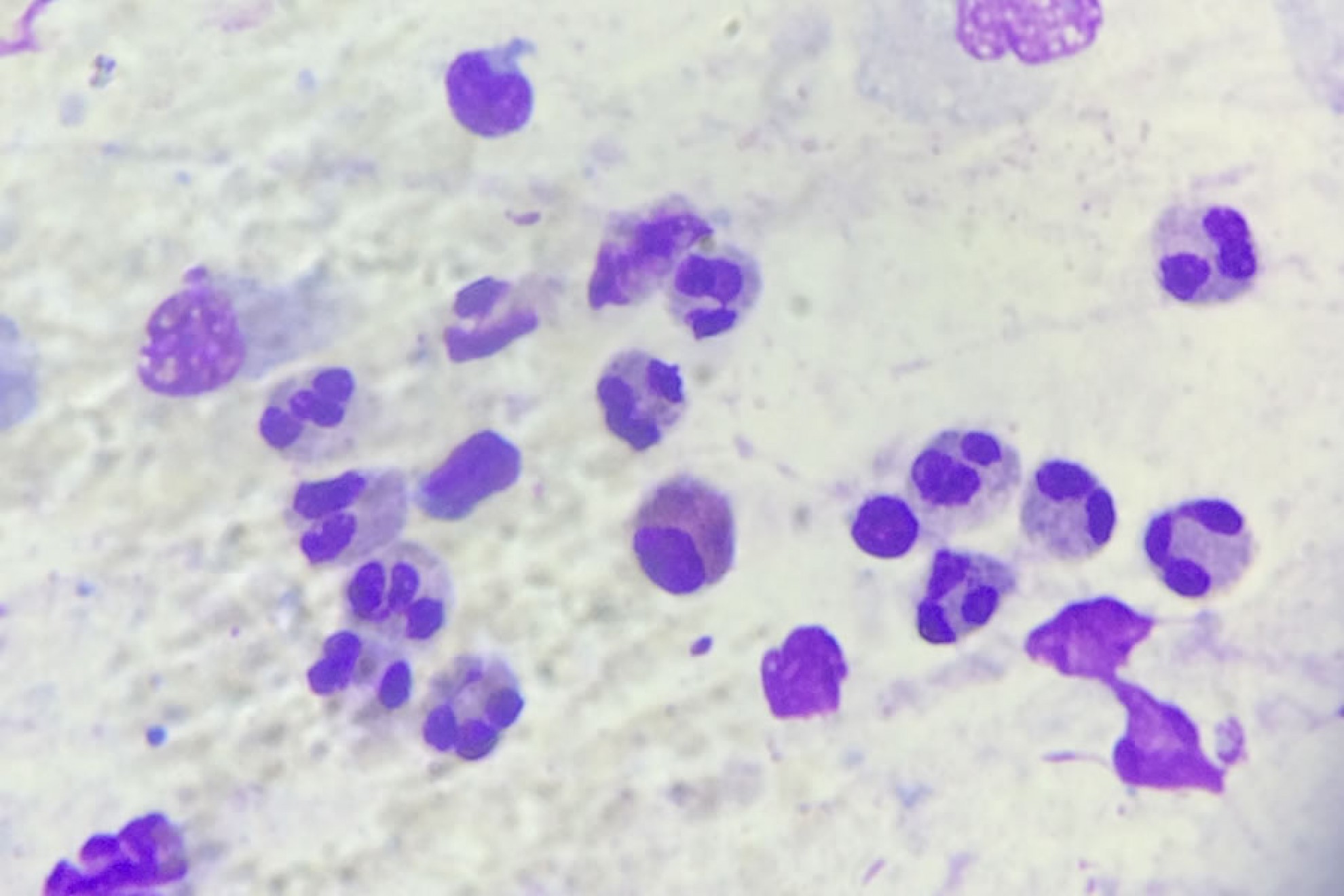 rinocitogramma neutrofili